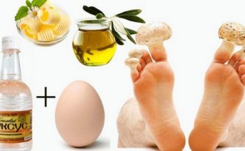 Уксус и яйцо против грибка ногтей: рецепты приготовления мази уксус с яйцом против грибка ногтей